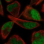 Atlas Antibodies Anti-PPME1 Antibody
