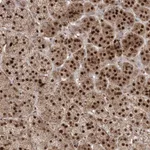 Atlas Antibodies Anti-PPOX Antibody
