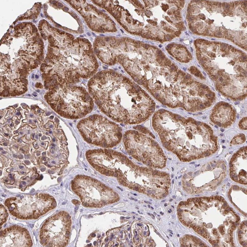 Atlas Antibodies Anti-PPP1CA Antibody