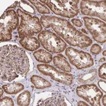 Atlas Antibodies Anti-PPP1CA Antibody