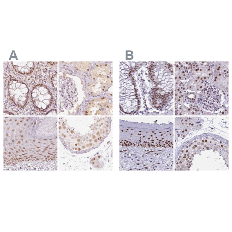 Atlas Antibodies Anti-PPP1R10 Antibody
