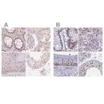 Atlas Antibodies Anti-PPP1R10 Antibody