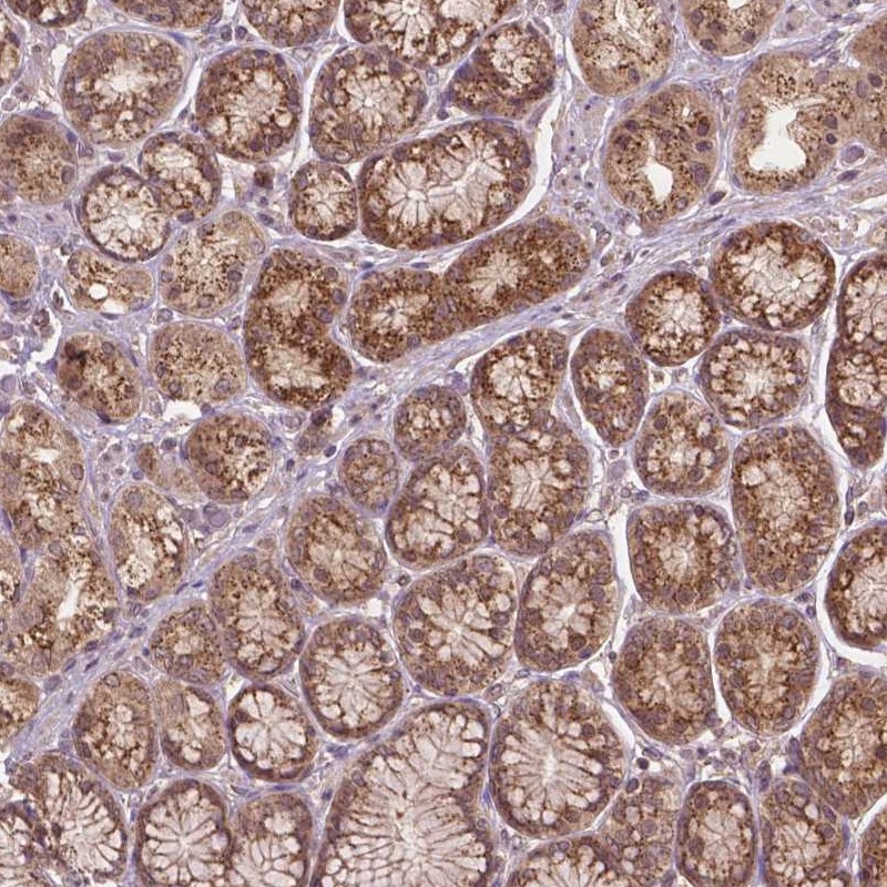 Atlas Antibodies Anti-PPP1CB Antibody