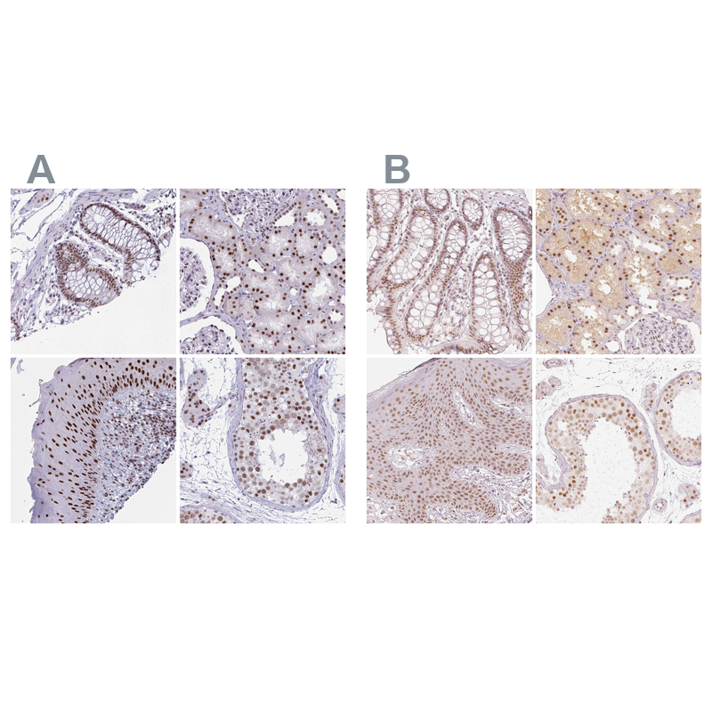 Atlas Antibodies Anti-PPP1R10 Antibody