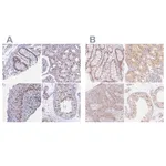 Atlas Antibodies Anti-PPP1R10 Antibody