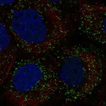 Atlas Antibodies Anti-PPP1R11 Antibody