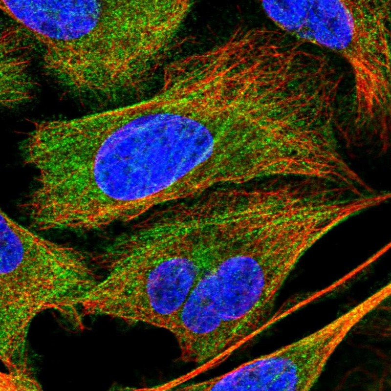 Atlas Antibodies Anti-PPP1R12A Antibody