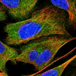 Atlas Antibodies Anti-PPP1R12A Antibody