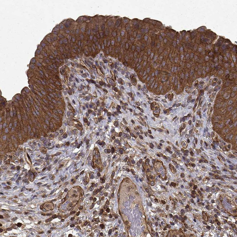 Atlas Antibodies Anti-PPP1R12A Antibody