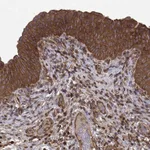 Atlas Antibodies Anti-PPP1R12A Antibody
