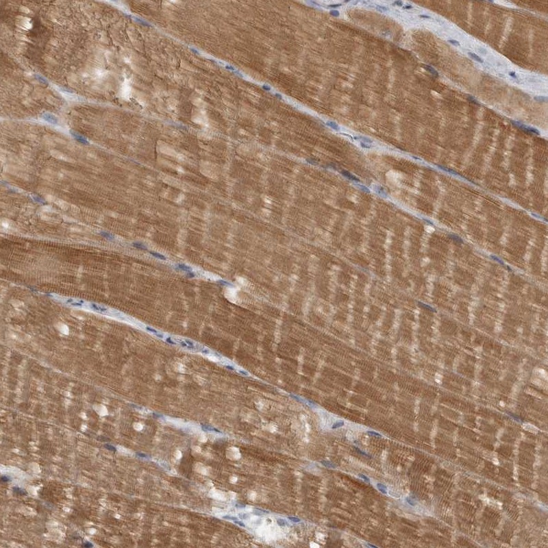 Atlas Antibodies Anti-PPP1R12B Antibody