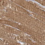 Atlas Antibodies Anti-PPP1R12B Antibody