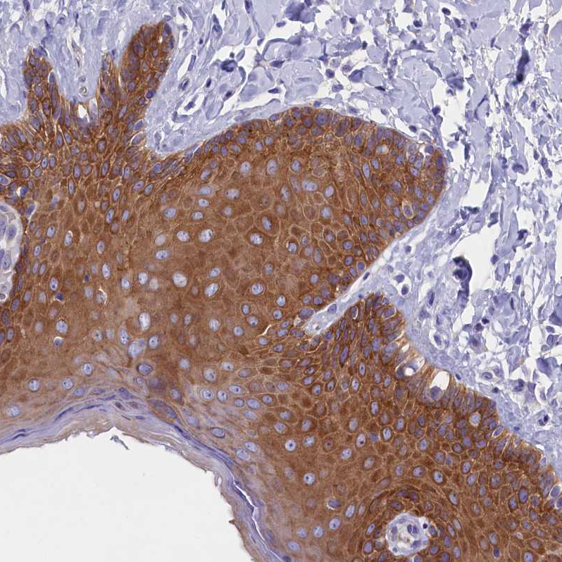 Atlas Antibodies Anti-PPP1R13L Antibody