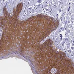 Atlas Antibodies Anti-PPP1R13L Antibody