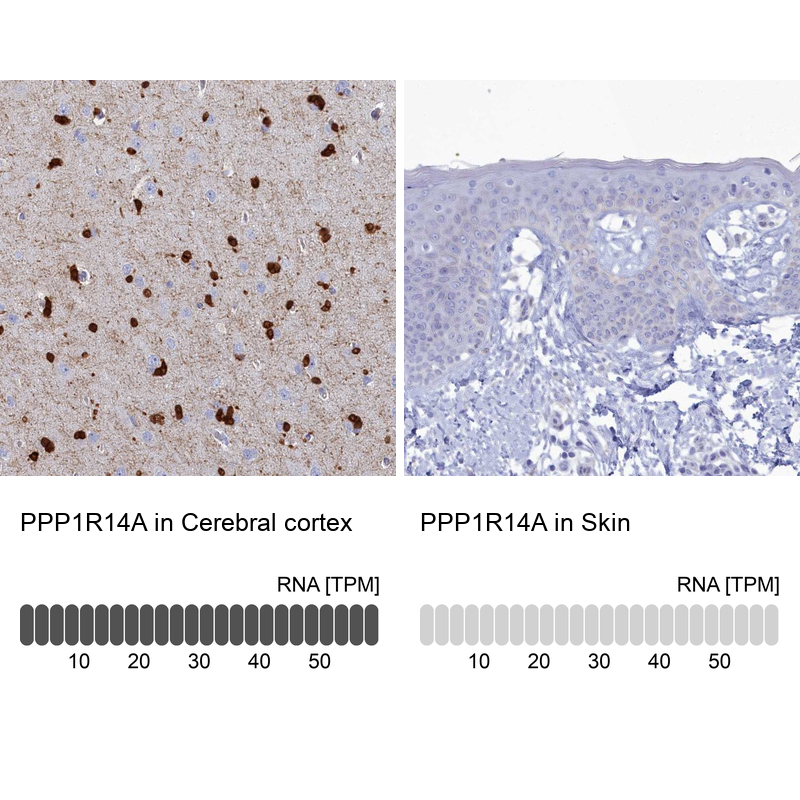Atlas Antibodies Anti-PPP1R14A Antibody