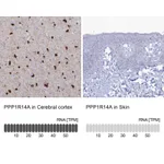 Atlas Antibodies Anti-PPP1R14A Antibody