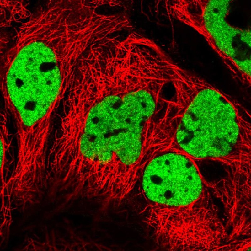 Atlas Antibodies Anti-PPP1R14A Antibody