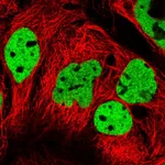 Atlas Antibodies Anti-PPP1R14A Antibody