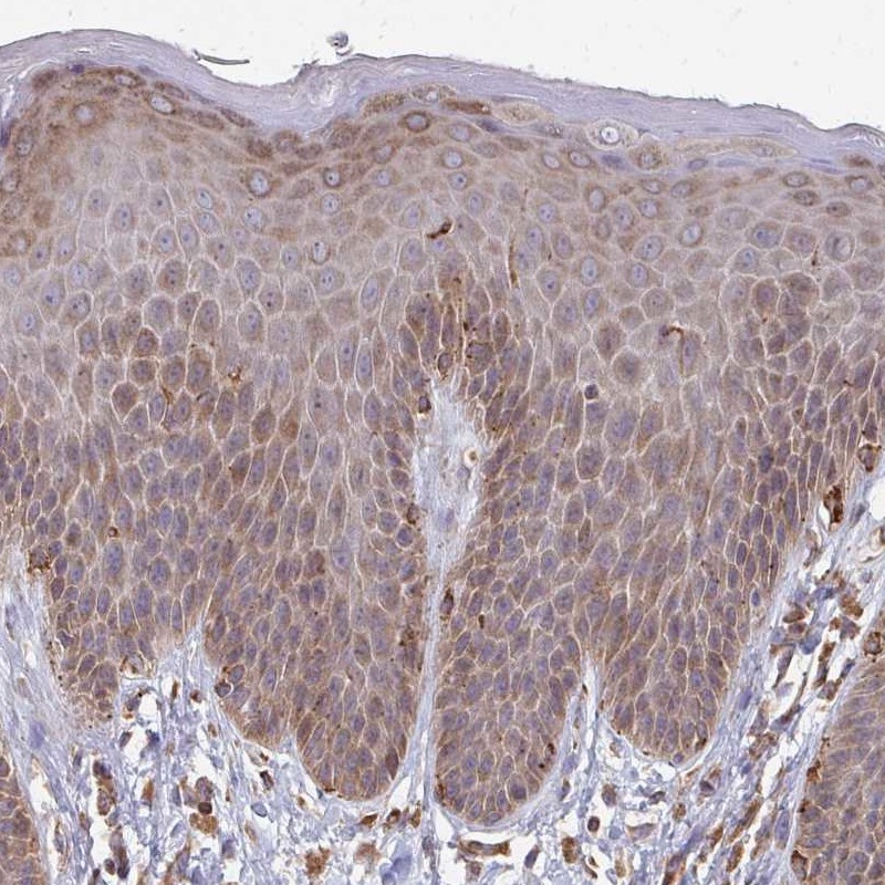 Atlas Antibodies Anti-PPP1R13L Antibody