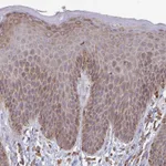 Atlas Antibodies Anti-PPP1R13L Antibody