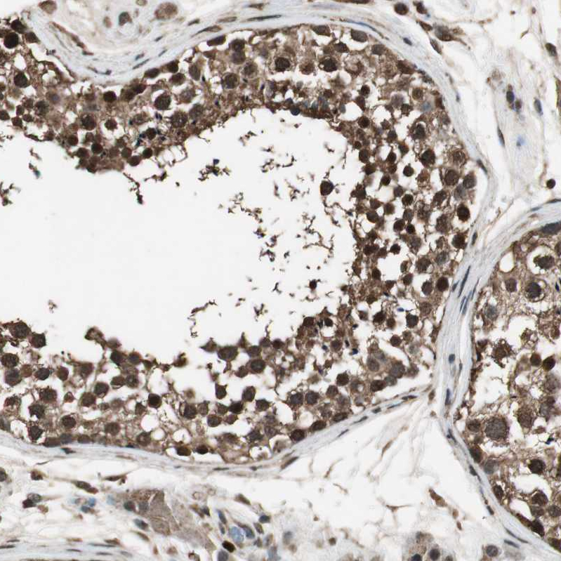 Atlas Antibodies Anti-PPP1R13B Antibody