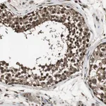 Atlas Antibodies Anti-PPP1R13B Antibody