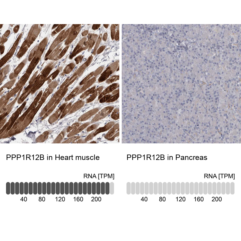 Atlas Antibodies Anti-PPP1R12B Antibody