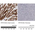 Atlas Antibodies Anti-PPP1R12B Antibody