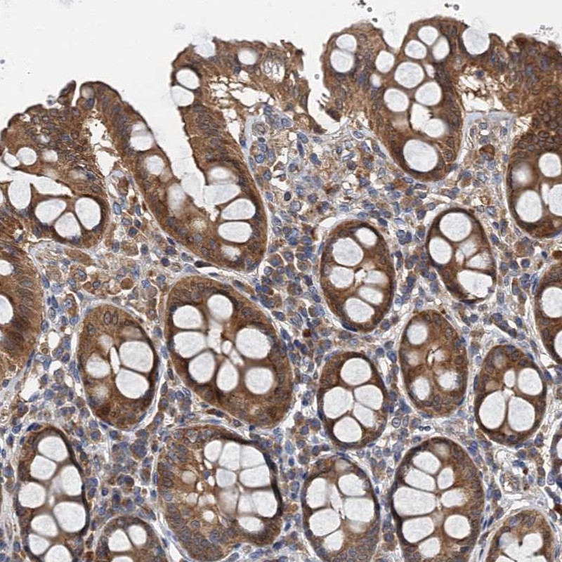 Atlas Antibodies Anti-PPP1R14D Antibody