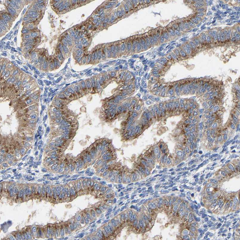 Atlas Antibodies Anti-PPP1R15A Antibody