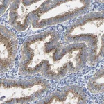 Atlas Antibodies Anti-PPP1R15A Antibody