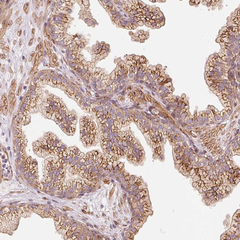 Atlas Antibodies Anti-PPP1R14B Antibody