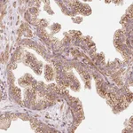 Atlas Antibodies Anti-PPP1R14B Antibody