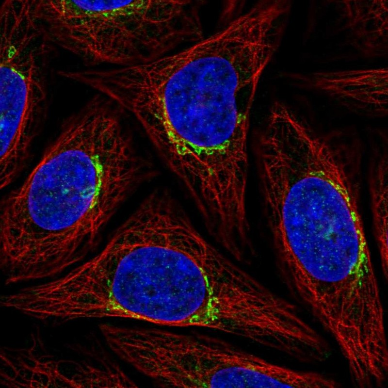 Atlas Antibodies Anti-PPP1R15B Antibody