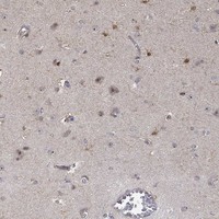 Atlas Antibodies Anti-PPP1R16B Antibody