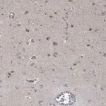 Atlas Antibodies Anti-PPP1R16B Antibody