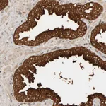 Atlas Antibodies Anti-PPP1R16A Antibody