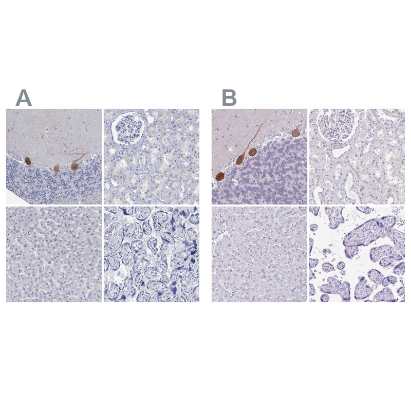 Atlas Antibodies Anti-PPP1R17 Antibody