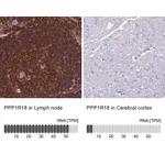 Atlas Antibodies Anti-PPP1R18 Antibody