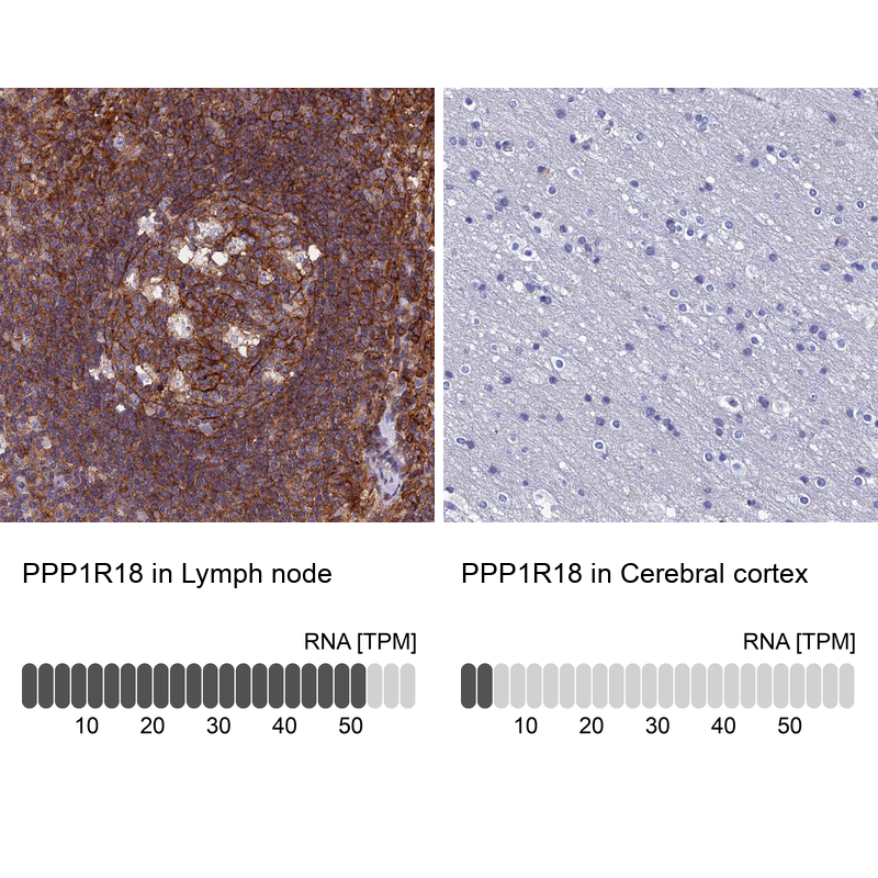 Atlas Antibodies Anti-PPP1R18 Antibody