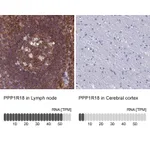 Atlas Antibodies Anti-PPP1R18 Antibody
