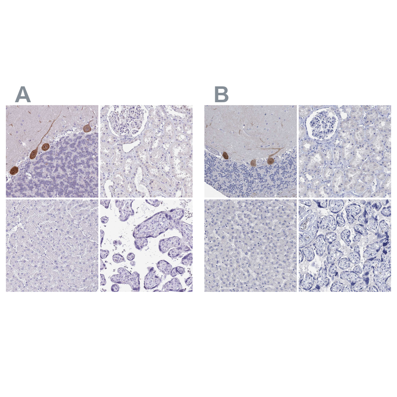 Atlas Antibodies Anti-PPP1R17 Antibody