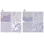 Atlas Antibodies Anti-PPP1R17 Antibody