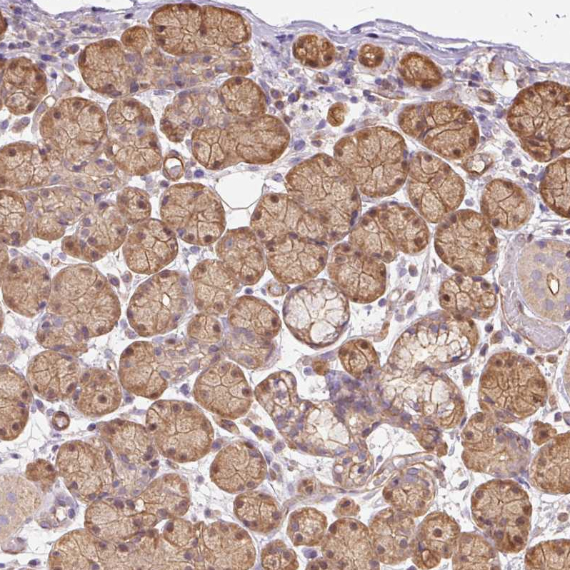 Atlas Antibodies Anti-PPP1R1B Antibody