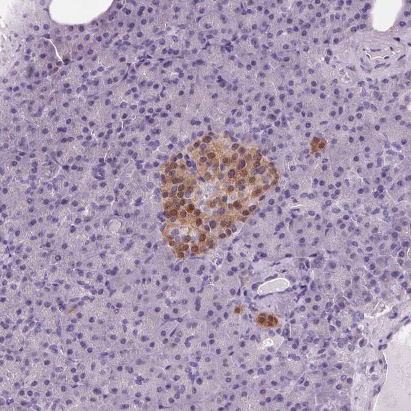 Atlas Antibodies Anti-PPP1R1A Antibody