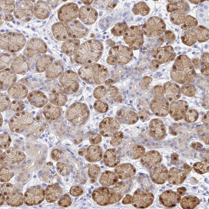 Atlas Antibodies Anti-PPP1R1B Antibody