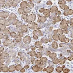 Atlas Antibodies Anti-PPP1R1B Antibody