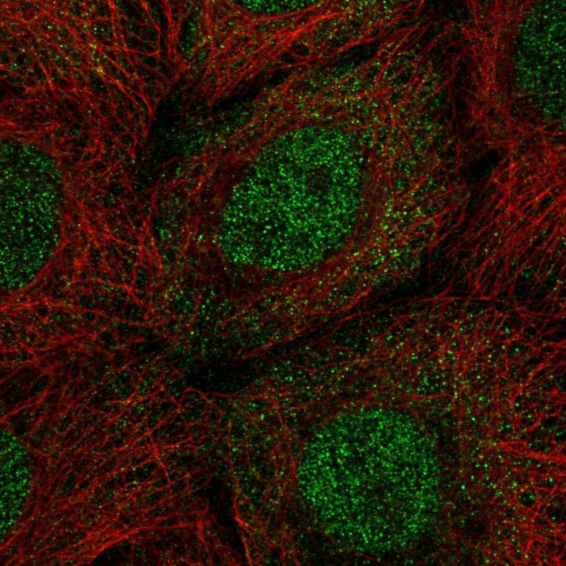 Atlas Antibodies Anti-PPP1R2 Antibody