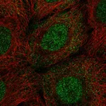 Atlas Antibodies Anti-PPP1R2 Antibody