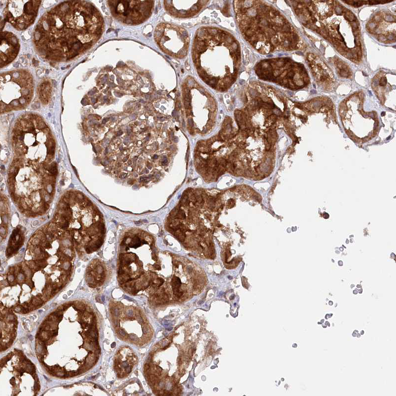 Atlas Antibodies Anti-PPP1R21 Antibody